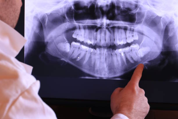 Best Walk-In Emergency Dental Services in Grizzly Flats, CA